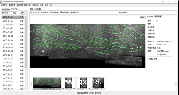 眼角膜圖像自動(dòng)拼接及分析系統(tǒng)