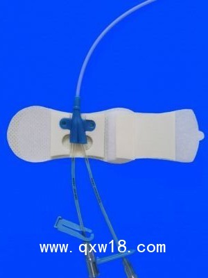 一次性導管固定裝置（PICC導管固定裝置）