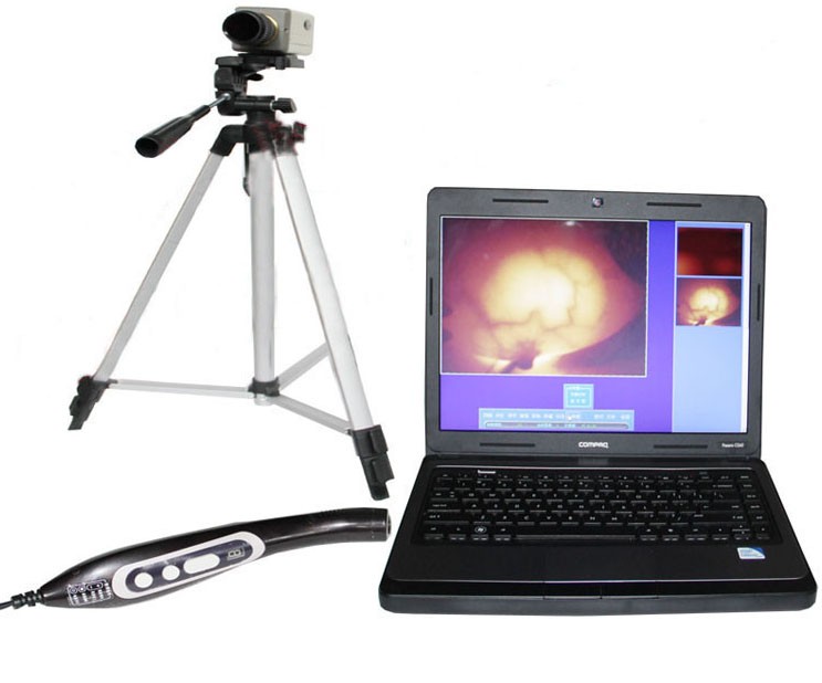 供應(yīng)乳腺病檢測(cè)分析儀（紅外線乳透機(jī)）