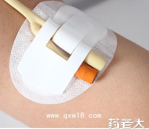 引流管固定裝置