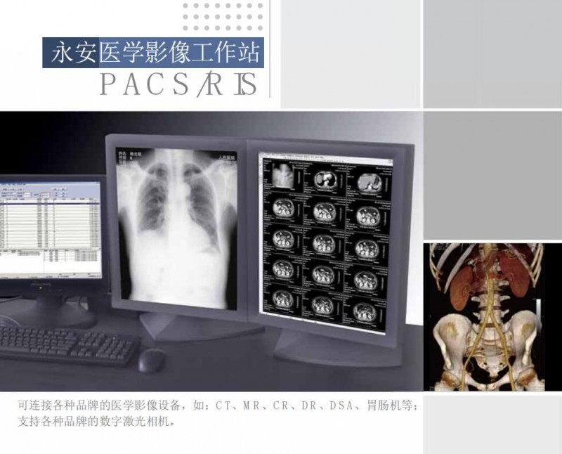 影像工作站（超聲、DR、CT、核磁）軟件廠家