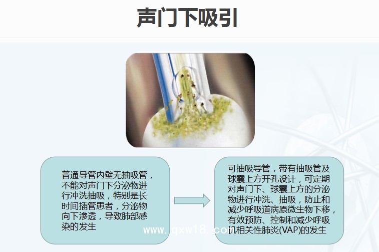 《麻醉重癥》可抽吸加強型氣管插管（聲門下吸引）