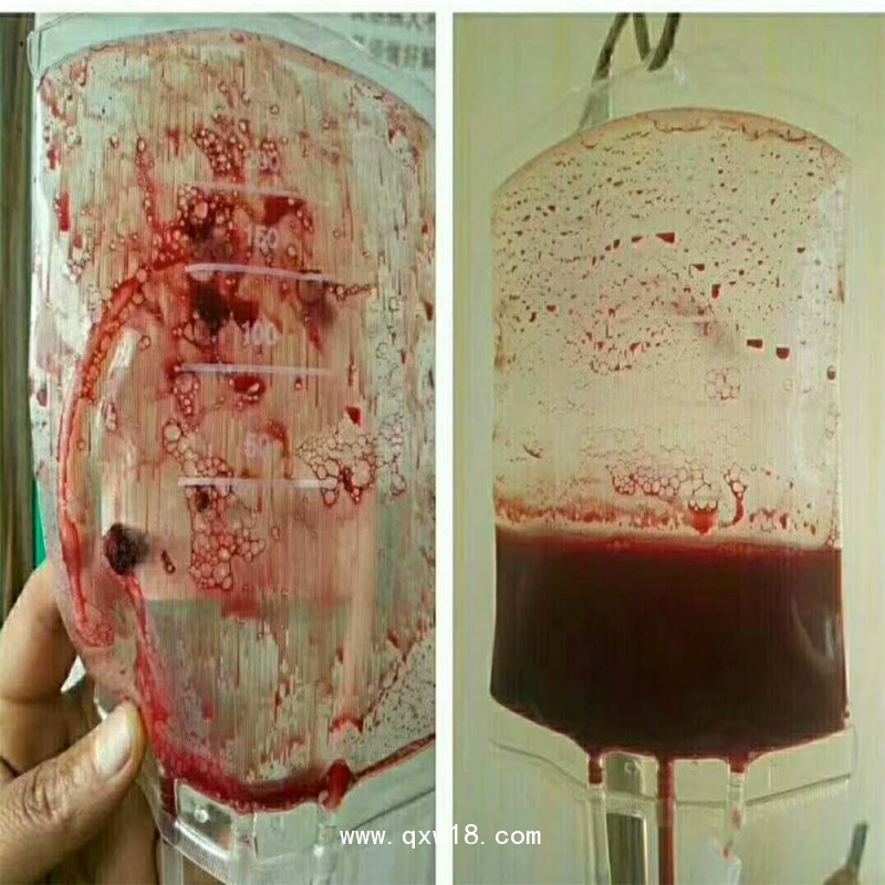 血袋、大自血血袋三大廠家南京賽爾金、蘇州萊仕、四川南格爾