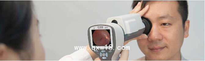 芬蘭OPTMED便攜眼底照相機(jī)
