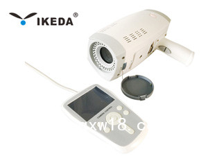 數(shù)碼電子陰道鏡 便攜式數(shù)碼電子陰道鏡