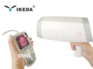 數(shù)碼電子陰道鏡 便攜式數(shù)碼電子陰道鏡