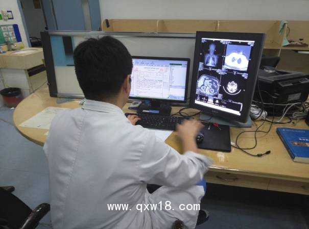 華益精點放射醫(yī)學影像診斷工作站