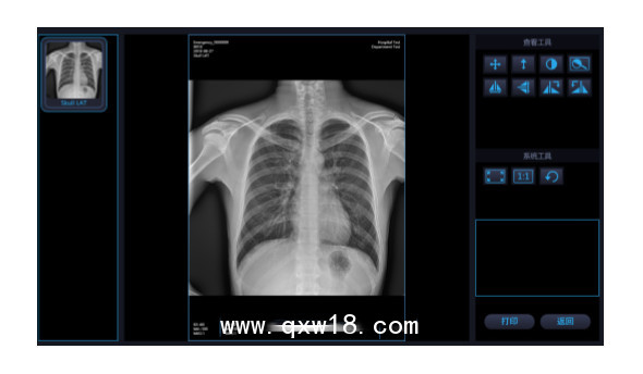 國內品牌 移動式X光機 X射線拍片機
