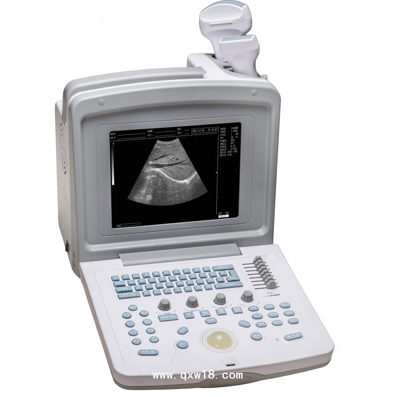 全數(shù)字超聲診斷系統(tǒng)