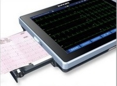 導(dǎo)聯(lián)自動分析心電圖機(jī)