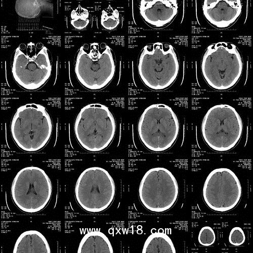 醫(yī)用膠片廠家