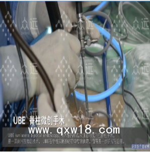UBE器械包，UBE融合器械包，UBE大直徑消融電極