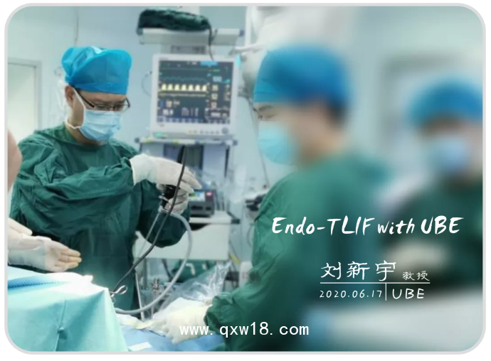 UBE器械包，UBE融合器械包，UBE大直徑消融電極