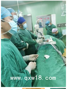 UBE 進(jìn)口雙通道手術(shù)醫(yī)療器械