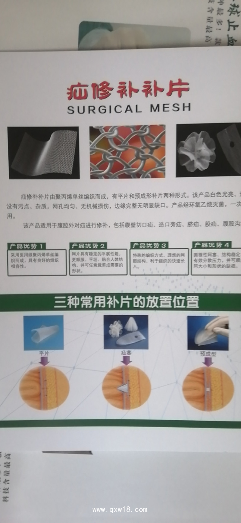 疝修補片，疝氣補片，補片