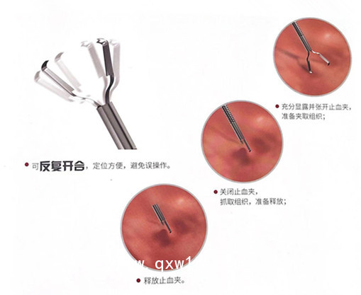 萬瑪醫療現貨提供唯德康一次性使用止血夾裝置