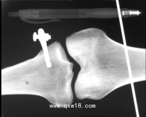 動(dòng)物X射線機(jī)