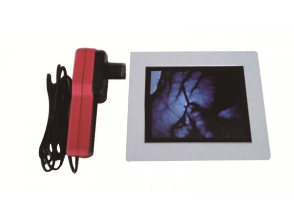 東發(fā)醫(yī)療廠家招商DF-700靜脈顯像儀血管顯像儀 靜脈定位儀