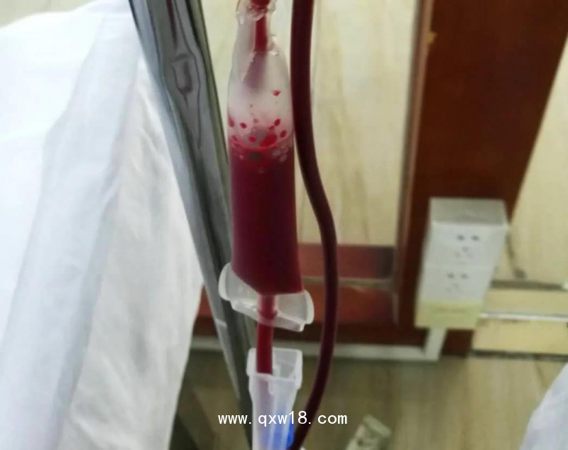 免疫三氧自體血療法心腦血管疾病的治療和預(yù)防