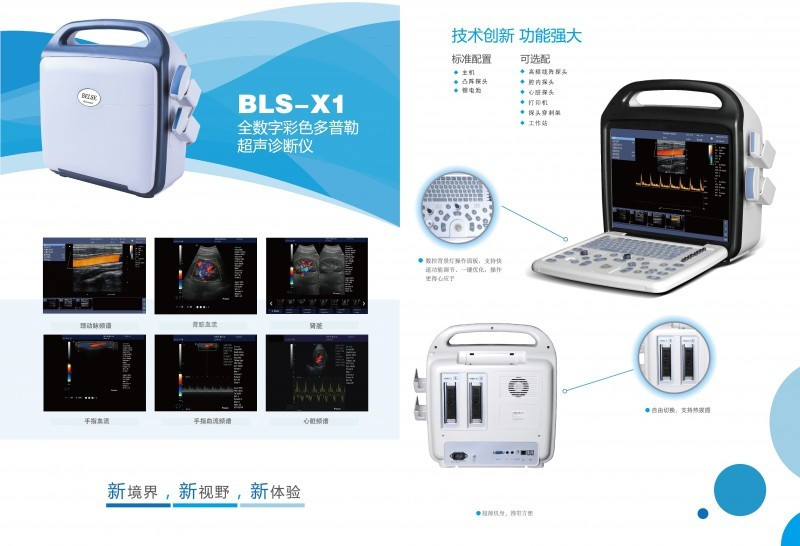 全數(shù)字彩色多普勒超聲診斷儀