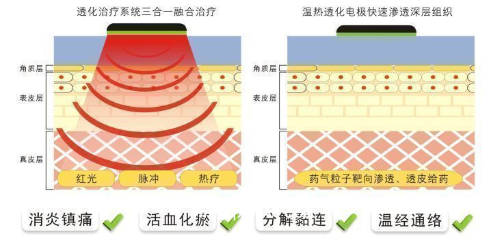 中頻理療儀 康復(fù)科甲類醫(yī)保新農(nóng)合100%報銷  觸摸屏操作