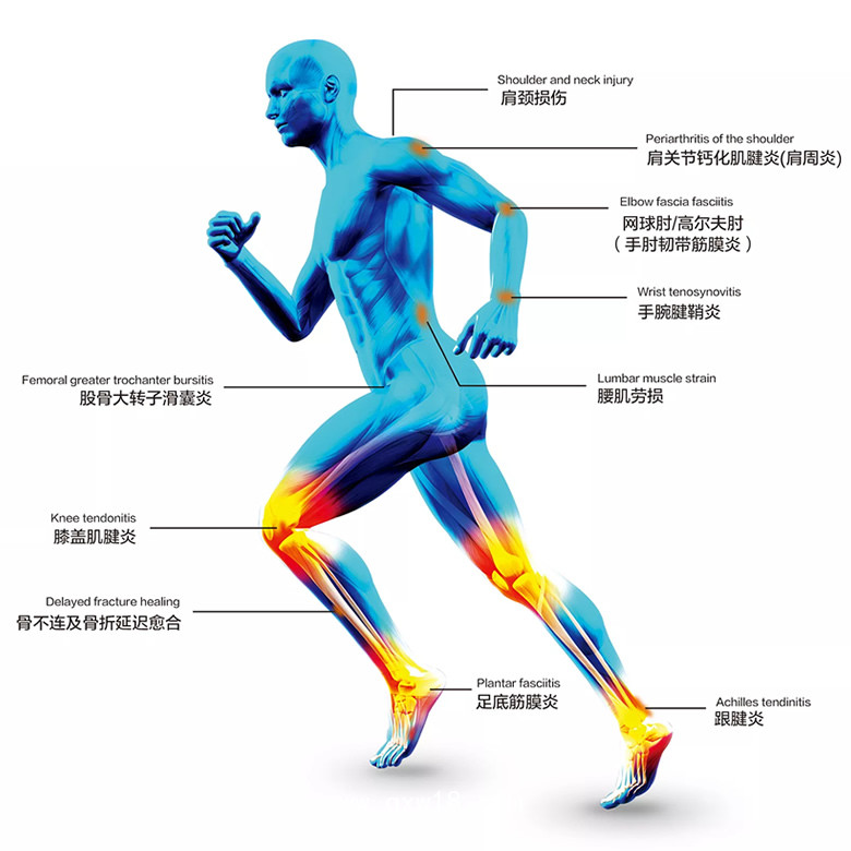 德國MTS 火花波液電式?jīng)_擊波治療儀