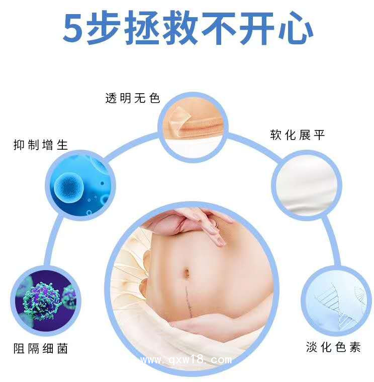 疤痕貼 疤痕修復(fù) 增生治療 貼牌代加工
