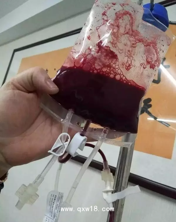 一次性大自血血袋，一次性輸血器，醫(yī)用臭氧儀等耗材產(chǎn)品批發(fā)