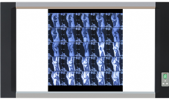 X射線膠片觀片燈