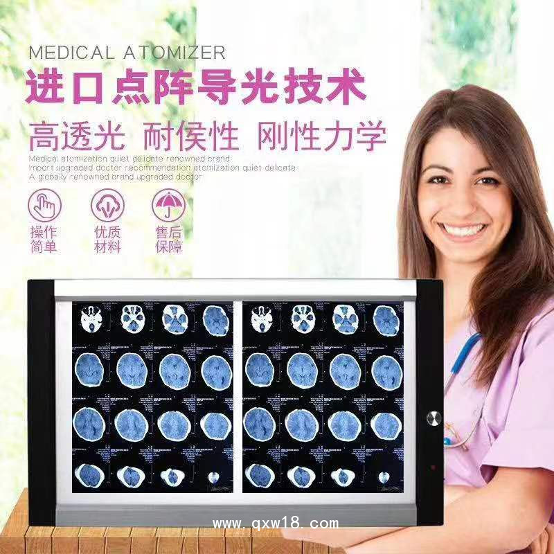 欣雨辰 YC-GP X射線膠片觀片燈 單聯(lián)/雙聯(lián)/三聯(lián)/四聯(lián)