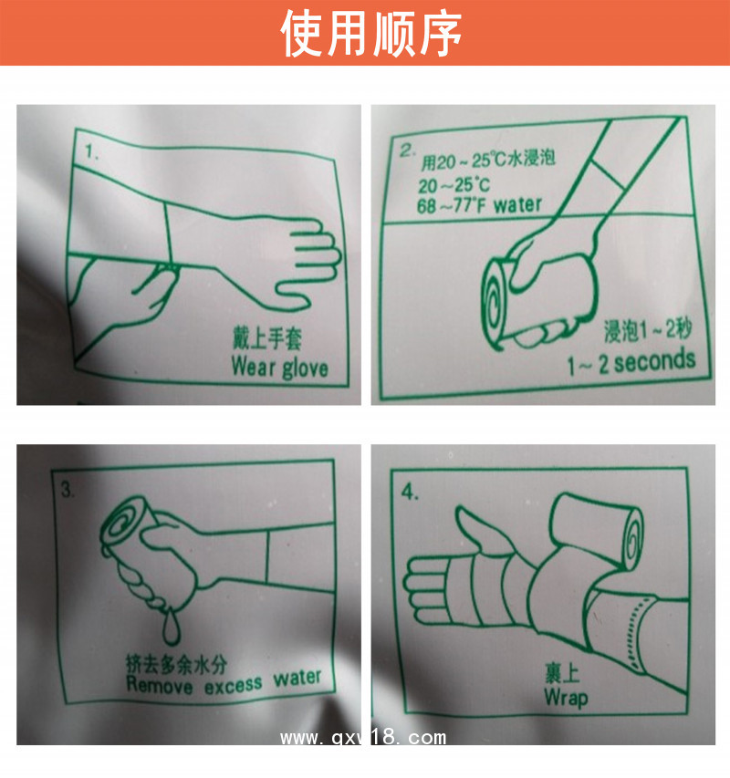 邦恩斯醫(yī)用高分子夾板繃帶 骨折石膏固定繃帶 手臂腳踝骨折繃帶