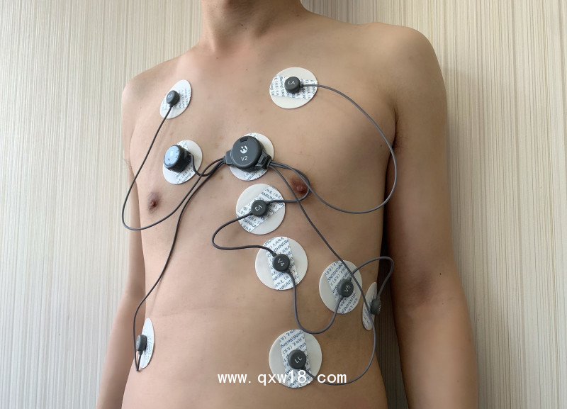 動態(tài)心電記錄儀 穿戴式心電記錄儀