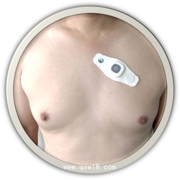 長時(shí)貼片式動(dòng)態(tài)心電記錄儀 專用心電電極 穿戴式心電傳感器