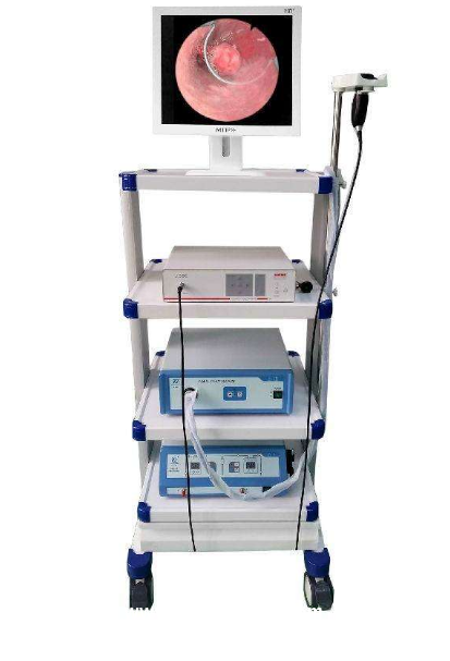 宮腔鏡醫(yī)用高清婦科檢查宮腔鏡高清內(nèi)窺鏡攝像系統(tǒng)國產(chǎn)宮腔鏡