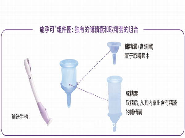 美國(guó)施孕可授精輔助系統(tǒng)家用助孕器
