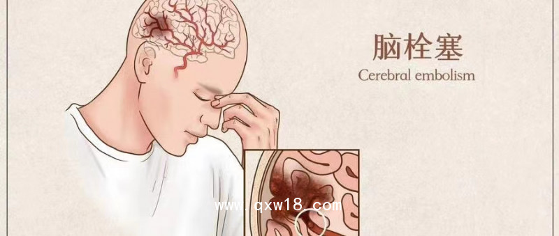 初鴻腦功能刺激儀 失眠治療儀BW-6911醫(yī)用豪華款