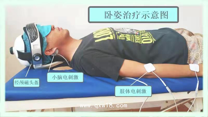 初鴻腦循環(huán)功能障礙治療儀 腦循環(huán)治療儀 腦功能障礙治療儀