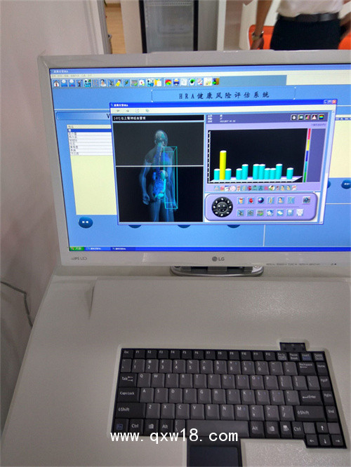 體檢中心設(shè)備配置清單HRA健康風(fēng)險(xiǎn)評估系統(tǒng)