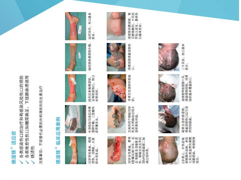 德濕銀敷料、銀離子