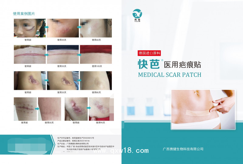 快芭醫(yī)用疤痕貼