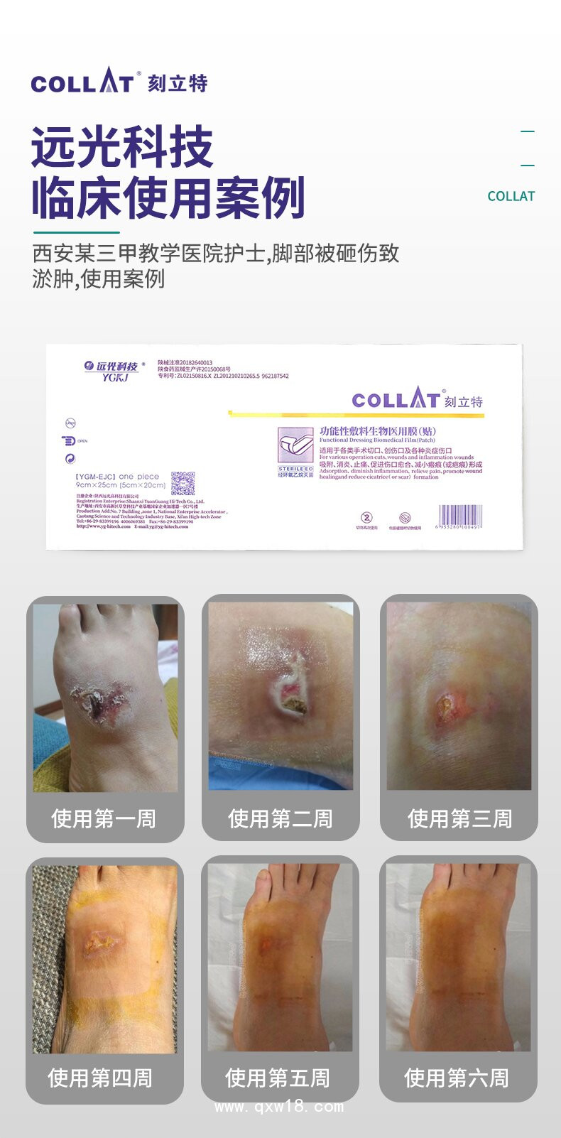 生物醫(yī)用復(fù)合材料---生物醫(yī)用膜（貼）----創(chuàng)口敷料