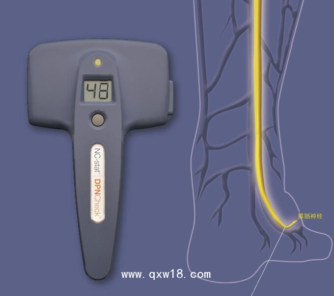 紐諾麥斯神經(jīng)傳導(dǎo)速度測量儀 NC-stat DPNCheck
