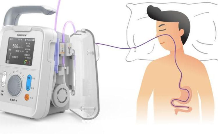 營養(yǎng)泵 Sunfusion ENP-1