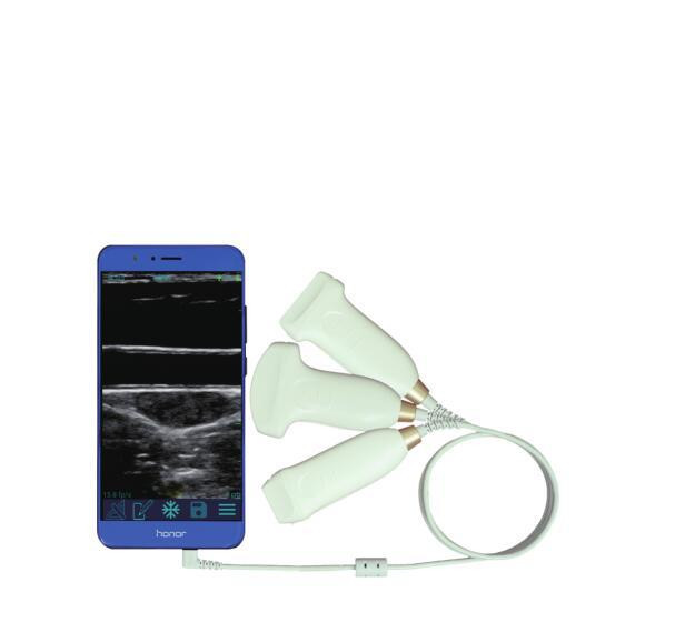 智影便攜式彩色多普勒超聲診斷系統(tǒng) PA12A