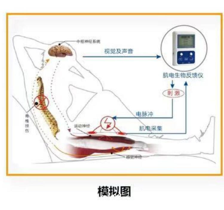 諾誠肌電生物反饋儀 XCH-B2