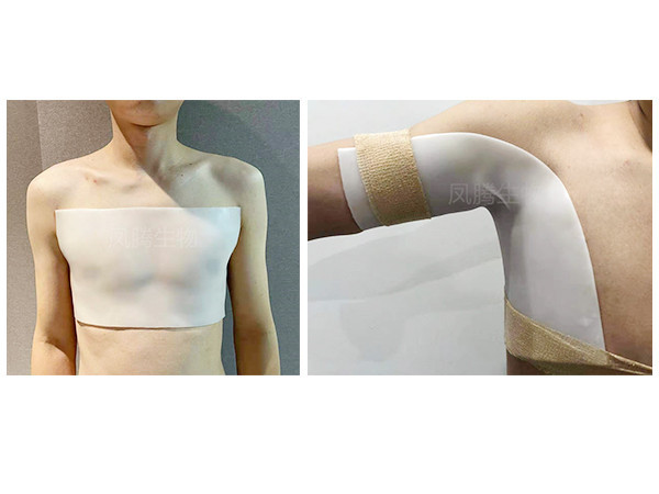 醫(yī)用外固定可塑性夾板(含硅酮凝膠)