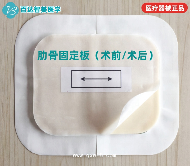 肋骨固定板/心胸外科術(shù)后護(hù)板/可塑形記憶合金夾板百達(dá)智美醫(yī)學(xué)