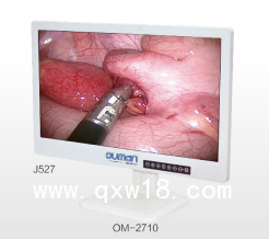 內窺鏡影像系統(tǒng)高清4K影像