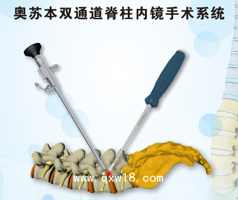 骨科脊柱微創(chuàng)手術(shù)器械 山東奧蘇本生產(chǎn)廠家