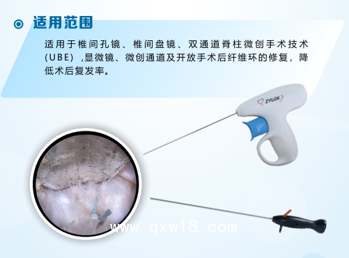 國產(chǎn)骨科非帶量高值耗材一次性纖維環(huán)縫合器